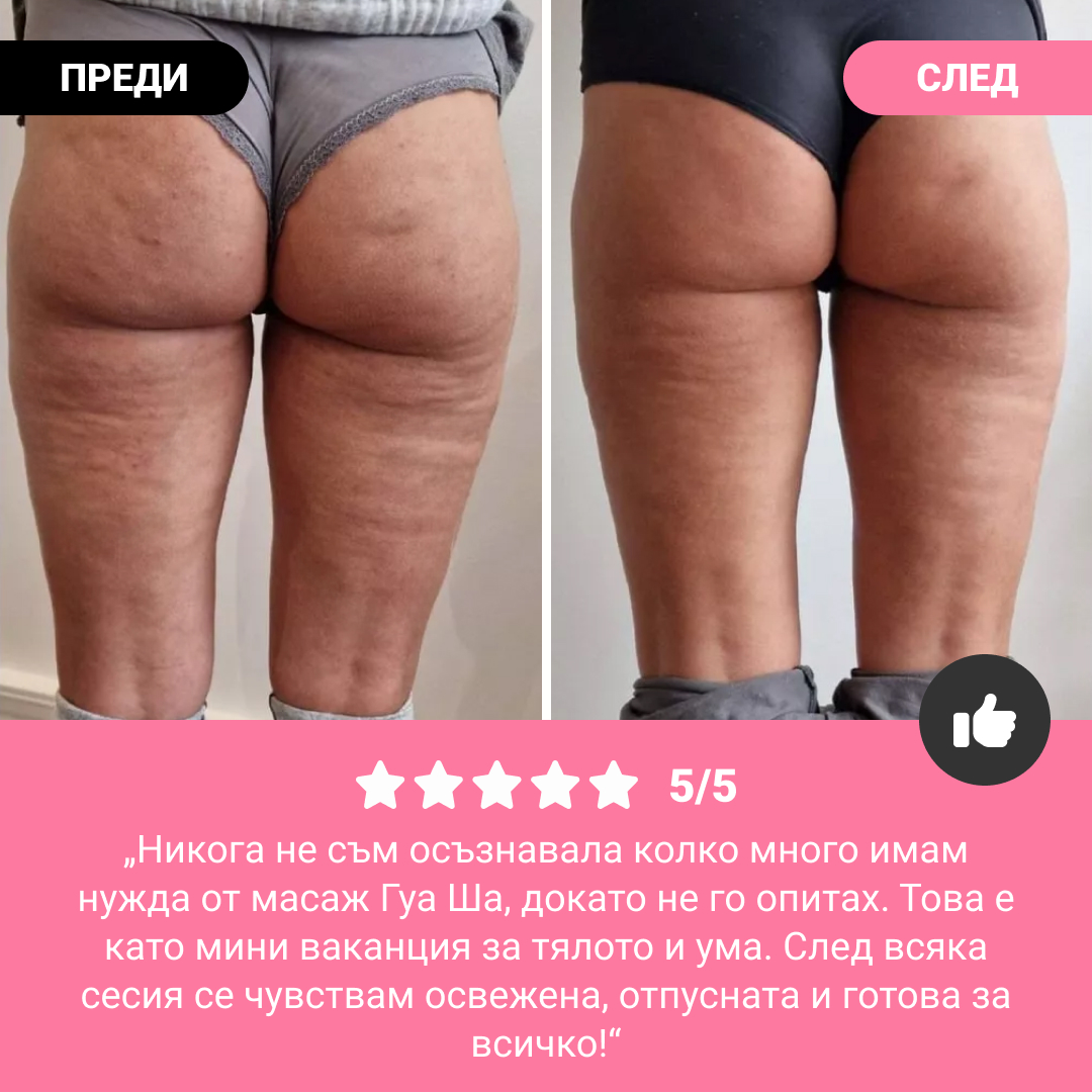 GUASHA – ролер за моделиране на тялото за видимо намаляване на целулита и мазнините - Image 7